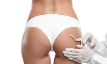 cellulite gambe e glutei