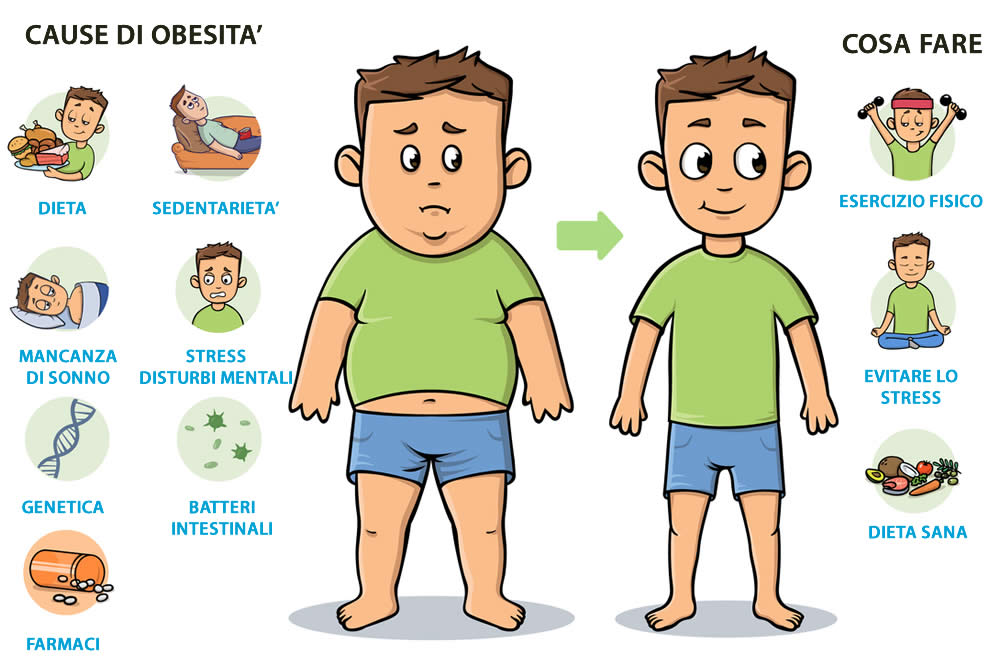 Cause Obesità