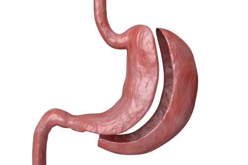 In questo articolo parliamo di Sleeve Gastrectomy, spiegando Cos'è, Come si Svolge e per quali Pazienti è Indicata. Risultati Attesi, Dieta Post-Operatoria, Controindicazioni e Possibili Effetti Collaterali