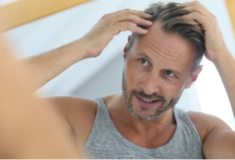 Caduta dei Capelli | Quando è Eccessiva?