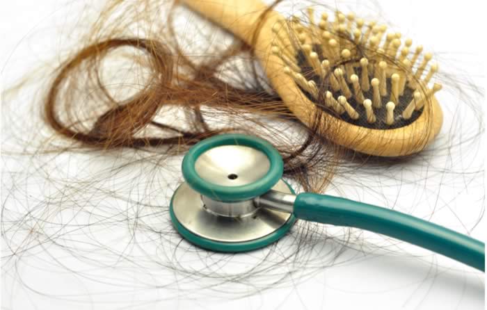 Capelli Caduta Diagnosi