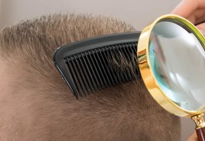 L'articolo fornisce le più Importanti Informazioni di base sui capelli. Scoprirai come sono fatti, come nascono dai follicoli capilliferi e perché possiedono certe caratteristiche; per finire, parleremo anche del cuoio capelluto e della cheratina.