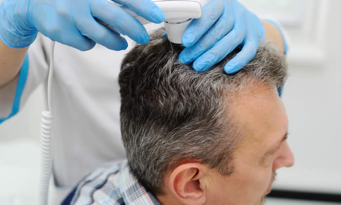 Alopecia | Diagnosi ed Esami