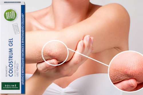 In questa recensione parliamo di Colostrum Gel (utile contro la pelle secca, sensibile, lievemente lesa o irritata), analizzandone ingredienti, efficacia, proprietà, modo d'uso, prezzo ed effetti collaterali, e presentandoti le migliori offerte online