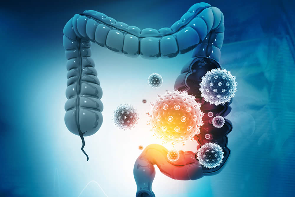 Acido Butirrico Funzioni E Benefici Per Intestino E Salute
