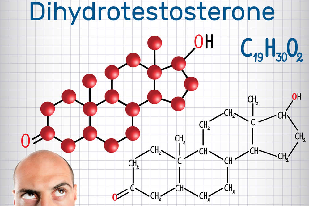 Diidrotestosterone - DHT