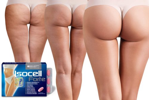 cellulite addio