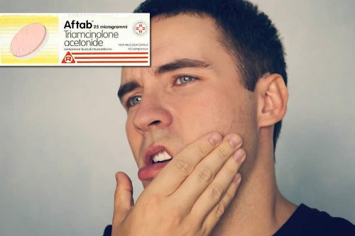 Recensione del Farmaco Aftab: A Cosa Serve? Quando Fa bene? Quando Fa Male? Principio attivo, Dosi e Uso Corretto del Triamcinolone acetonide contro Afte della Bocca e Stomatiti. Prezzo Aftab, Controindicazioni ed Effetti Collaterali
