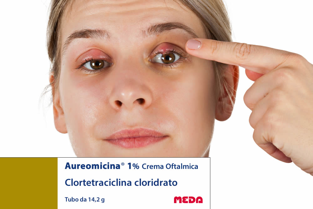 Aureomicina Crema Oftalmica 2019 | Foglio Illustrativo