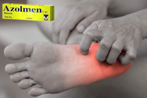 Recensione del Farmaco Azolmen Crema, Gel, Polvere e Soluzione: A Cosa Serve? Quando Fa bene? Quando Fa Male? Per Cosa si Usa? Principio attivo, Dosi e Uso Corretto contro Micosi di pelle e unghie. Prezzo Azolmen, Uso ed Effetti Collaterali