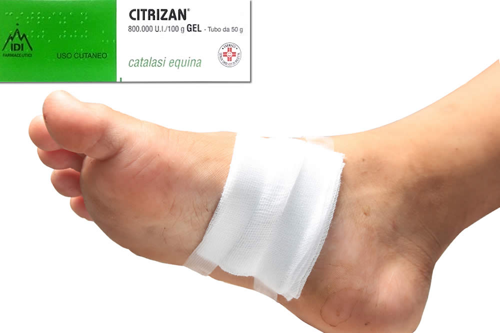 Citrizan Gel