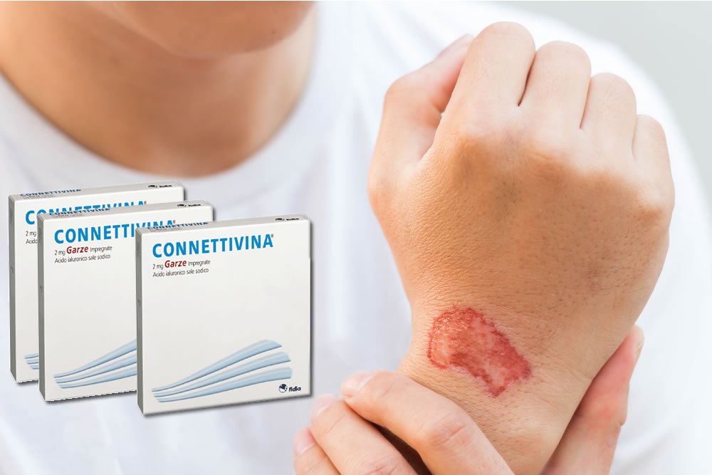 Connettivina Garze