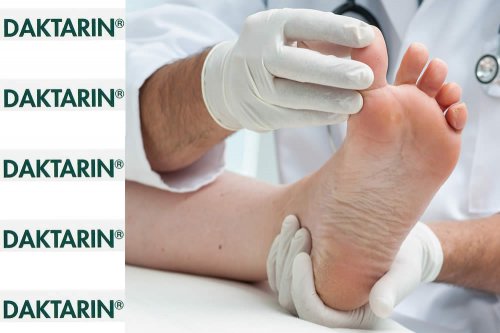 Recensione del Farmaco Daktarin Dermatologico: A Cosa Serve? Quando Fa bene? Quando Fa Male? Per Cosa si Usa? Dosi e Uso Corretto contro le Micosi della Pelle e delle Unghie. Controindicazioni, Gravidanza, Prezzo Daktarin Crema ed Effetti Collaterali