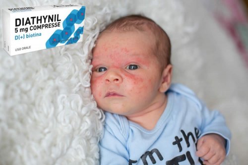 Recensione del Farmaco Diathynil Compresse: A Cosa Serve? Quando Fa bene? Quando Fa Male? Principio attivo, Efficacia, Dosi e Uso Corretto contro la Dermatite dell'Adulto e del Bambino. Prezzo Diathynil, Controindicazioni ed Effetti Collaterali