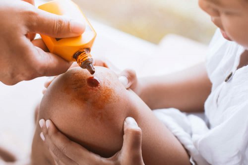 Eosina Disinfettante Cutaneo Foglio Illustrativo Spiegato