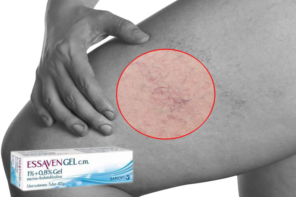 Essaven Gel