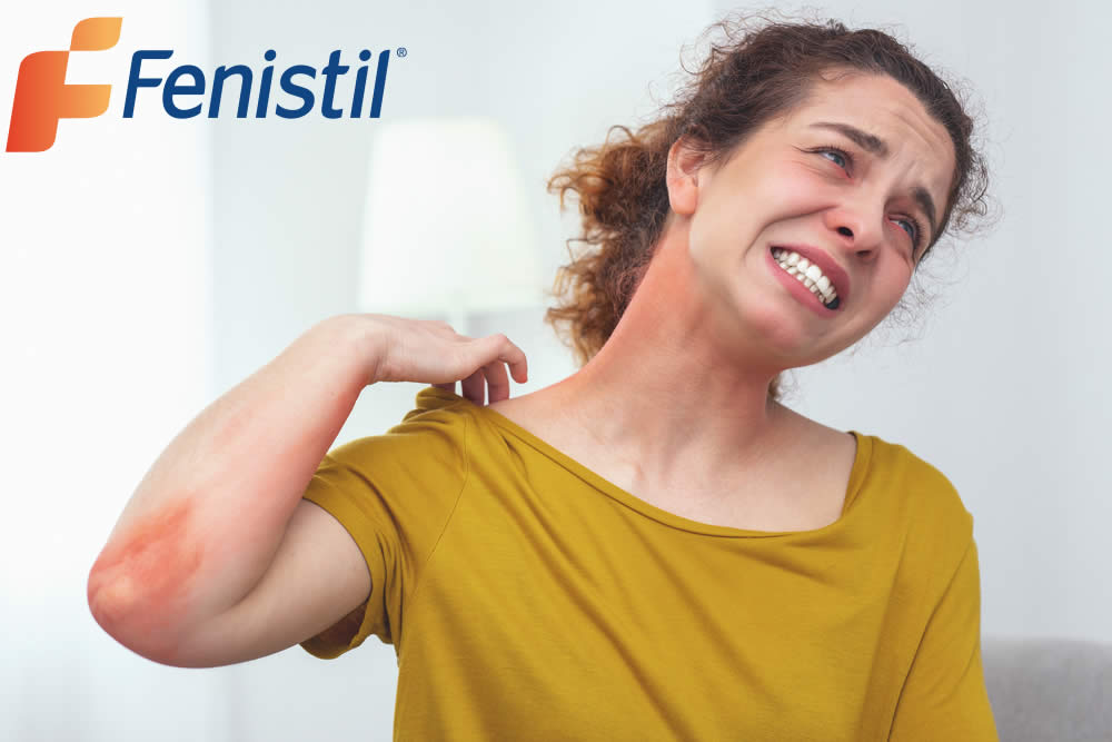 Fenistil