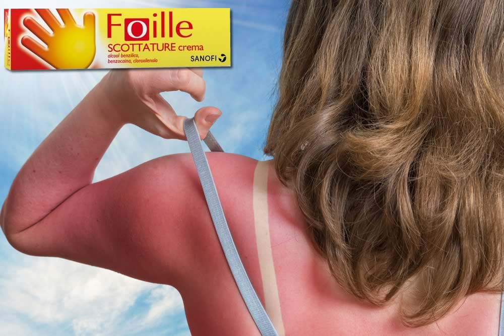 Foille Scottature
