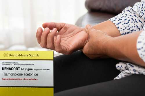 corticosteroidi improvvisi di perdita di peso