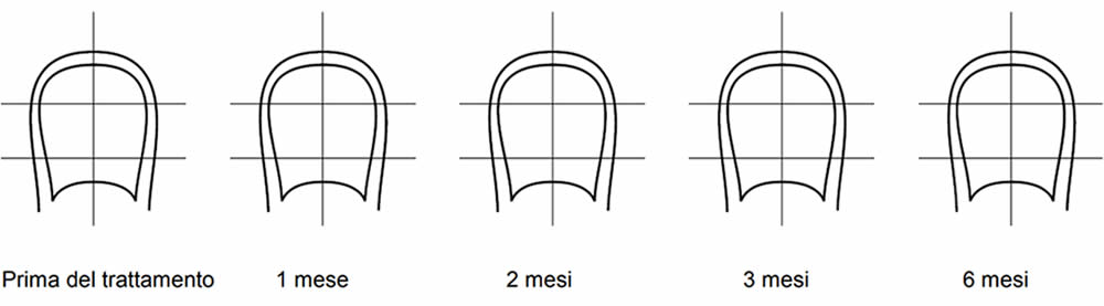 Onilaq Diagramma