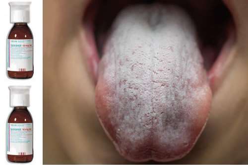 disfunzione erettile di lurasidone