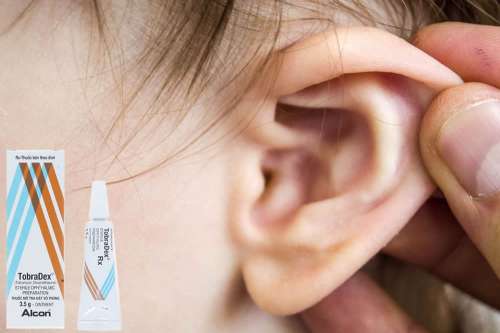 Tobradex Gocce Auricolari ® | Foglio Illustrativo Spiegato