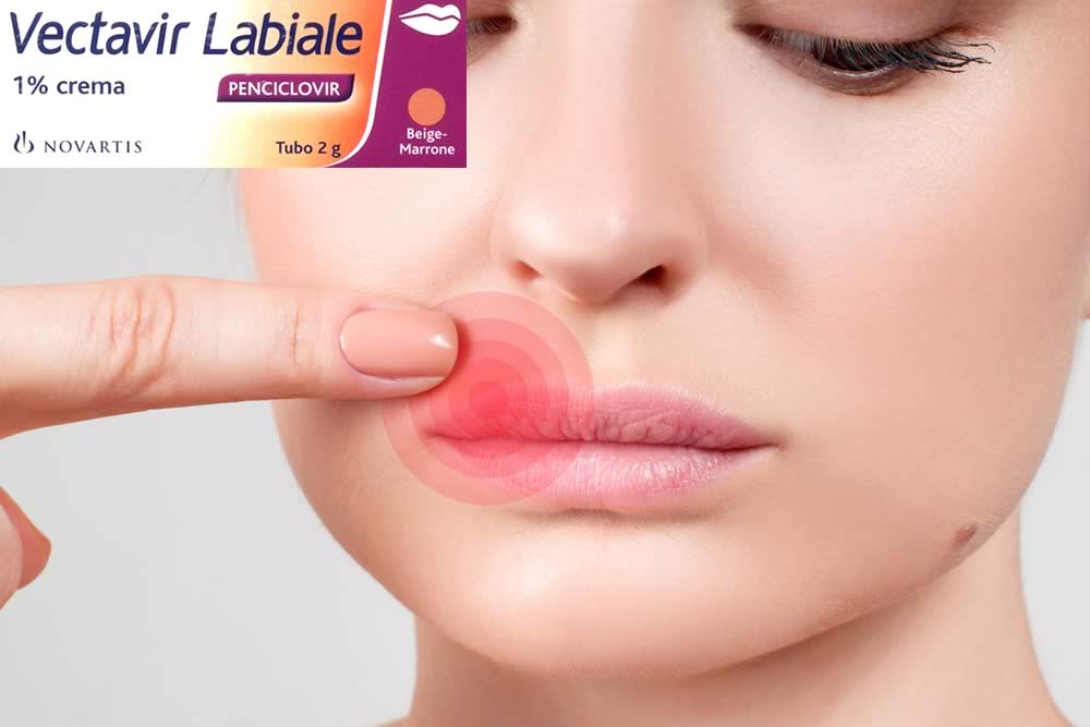Vectavir Labiale