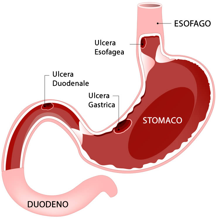 donne bodybuilding steroidi - Sei pronto per una buona cosa?