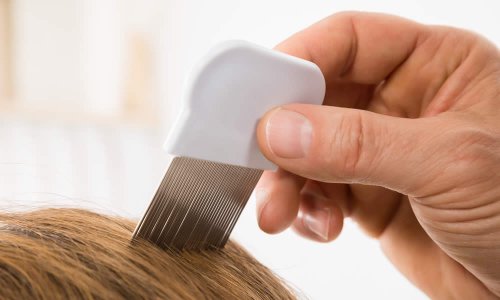 Pettini Pidocchi Efficacia Antipidocchi E Guida All Acquisto