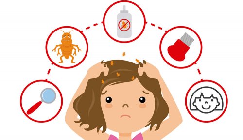 puressentiel anti pidocchi opinioni
