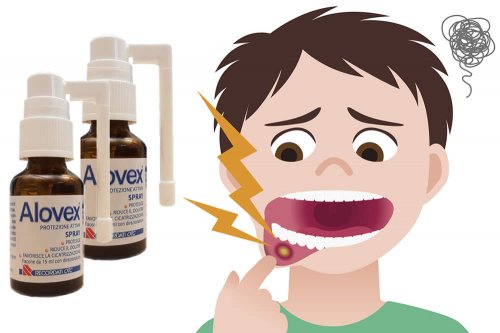In questa recensione parliamo di Alovex Spray (utile per il trattamento di afte e altre lesioni della bocca, grazie all'attività protettiva e cicatrizzante di aloe e acido ialuronico), analizzandone caratteristiche, vantaggi, uso e controindicazioni