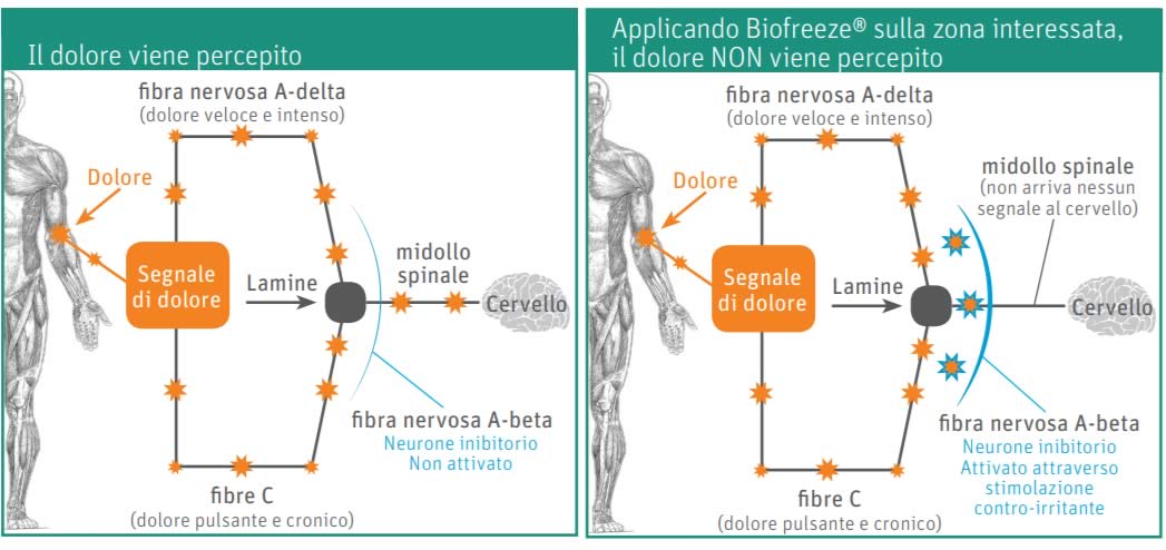 biofreeze - Contro il Dolore - Come Funziona