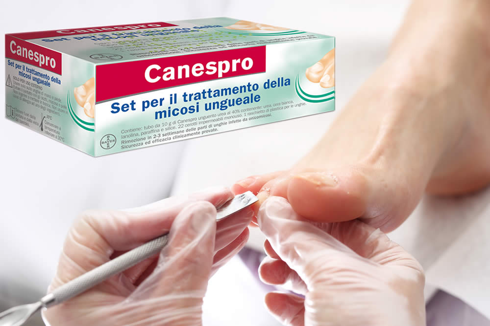 Canespro