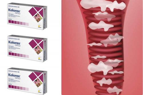 In questa recensione parliamo di Kolorex Ovuli Vaginali (a base di estratti di Pseudowintera colorata, utili per trattare candida e micosi vaginale) analizzandone ingredienti, efficacia, uso, prezzo ed effetti collaterali