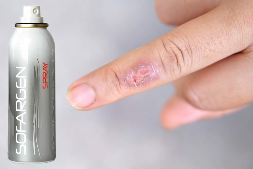 Sofargen Spray