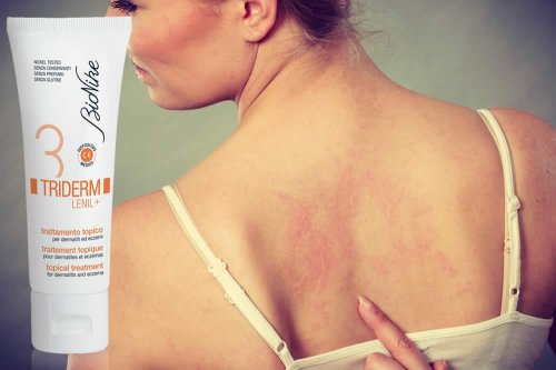 In questa recensione parliamo di Triderm Lenil Ag (dispositivo medico per il Trattamento Esterno di Dermatiti in Fase Acuta a rischio di Infezione), analizzandone ingredienti, composizione, efficacia, modo d'uso, controindicazioni ed effetti collaterali